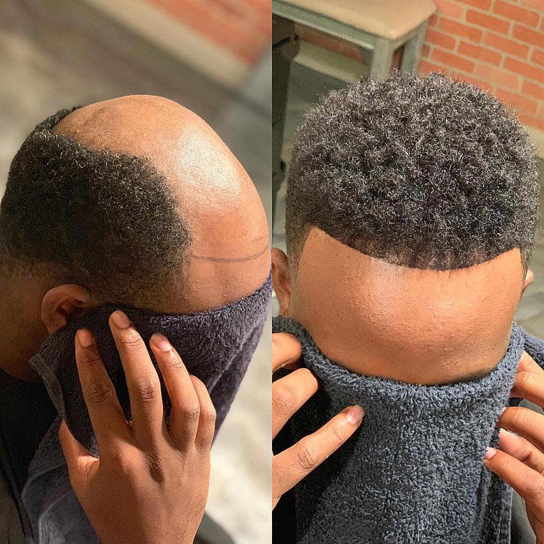 Short men's hair unit before-and-after result at The Men's Grooming Suite